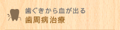 歯ぐきから血が出る 歯周病治療